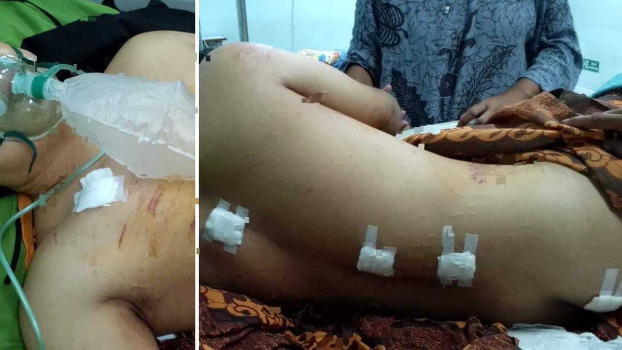 Jauh-Jauh Ingin Menemui Pujaan Hati, Malah Disambut Camer dengan 5 Kali Tikaman