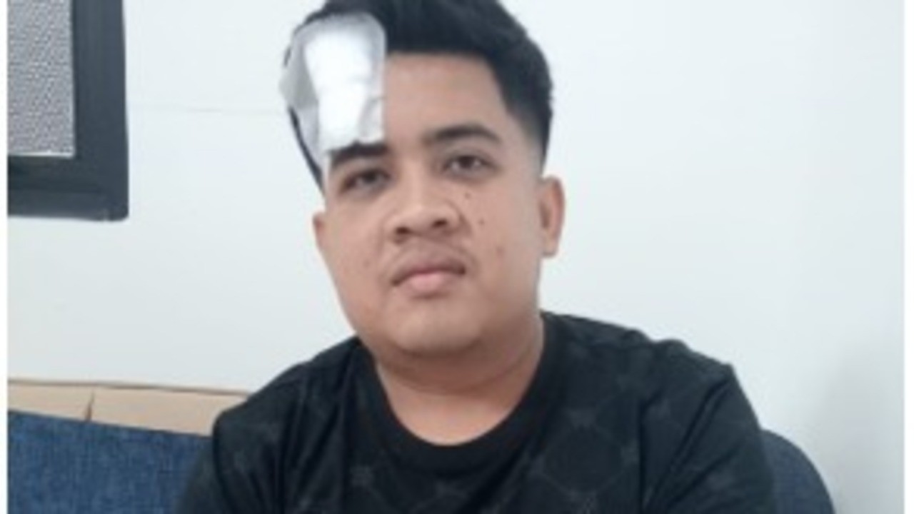 Polda Sumsel Amankan Tersangka Penganiayaan Maut di Diskotik Darma Agung