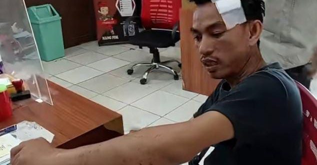 Dikeroyok di Kampung Baru Bersama Pacar,  Begini Kondisi DJ Ini 