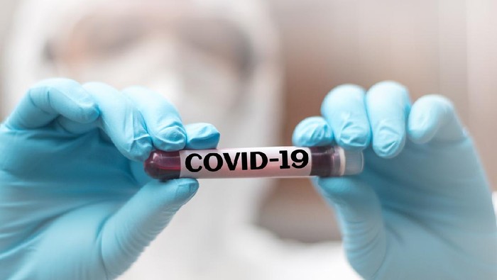 IndoVac, Vaksin Covid-19 Bio Farma Siap Suplai Pasar Global