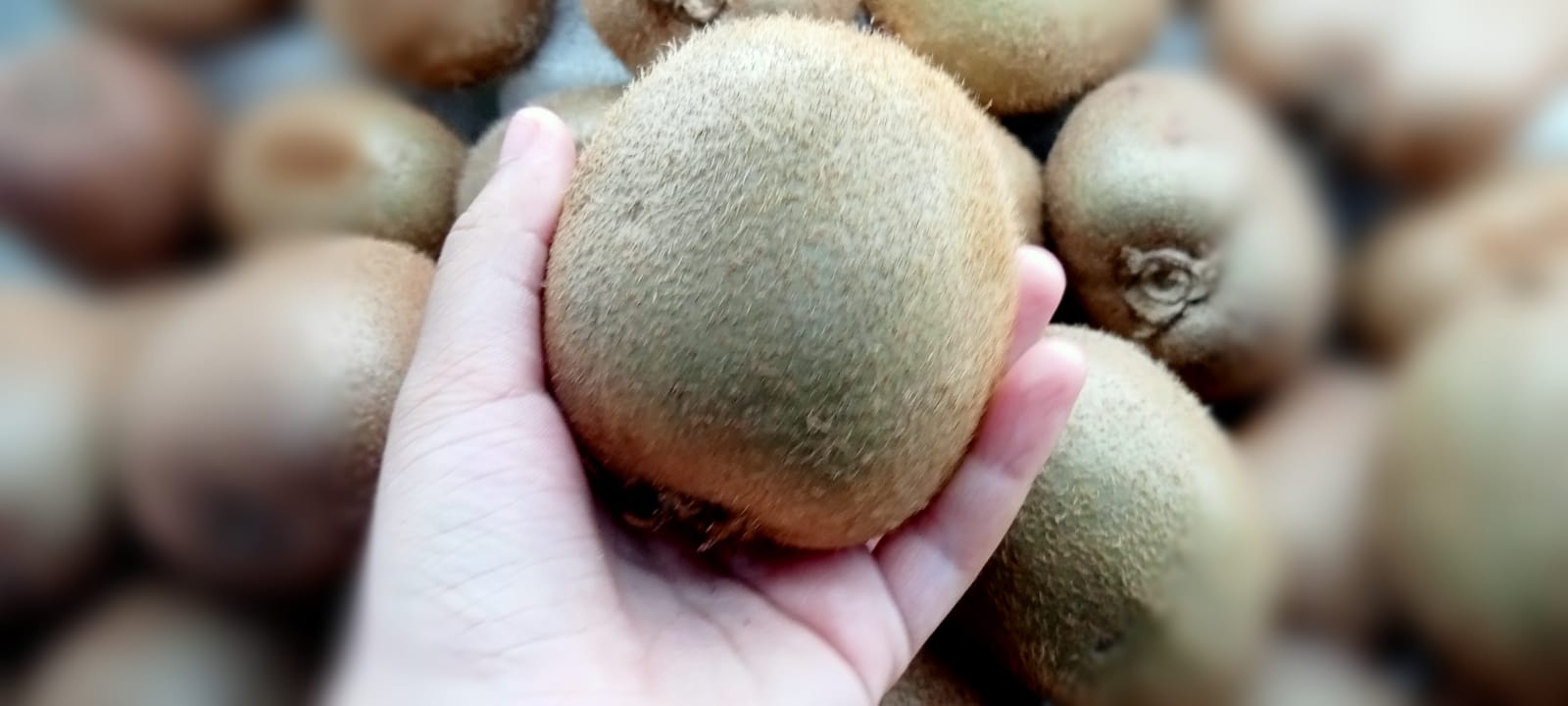 Masalah Rambut Rontok dan Ketombe !  Atasi Dengan Buah Kiwi Saja, Begini Caranya...