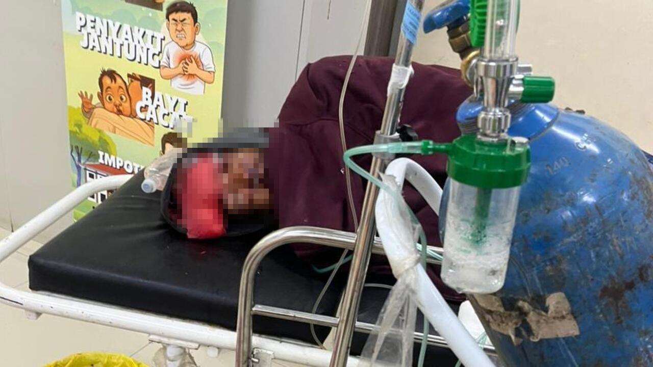 CRF vs PCX, 1 Tewas, 2 Luber dan 1 Luring