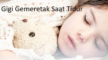 Begini Cara Mengatasi Gigi Gemeretak Saat Tidur