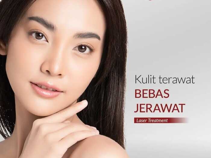 Tips dan Trik Bagaimana Mencegah Jerawat untuk Wajah yang Berseri!