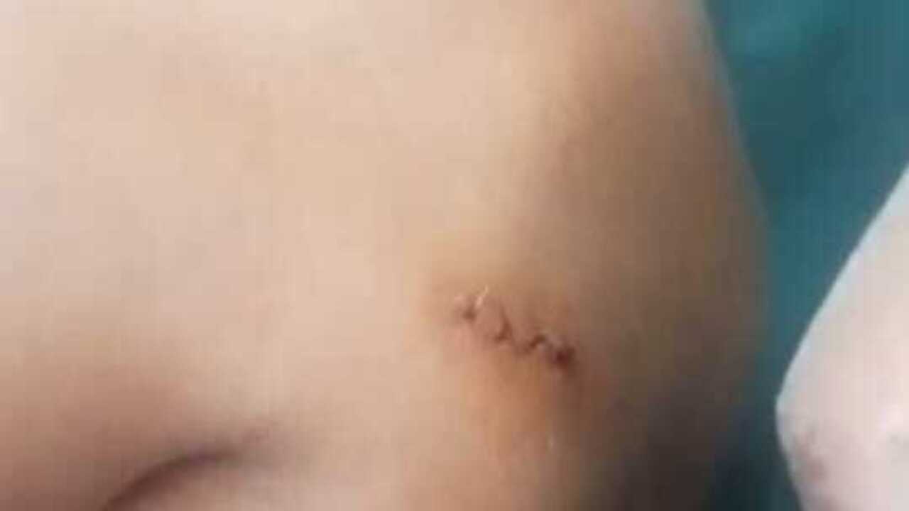Seorang Petani di Rawas Ilir Jadi Korban Penganiayaan Brutal