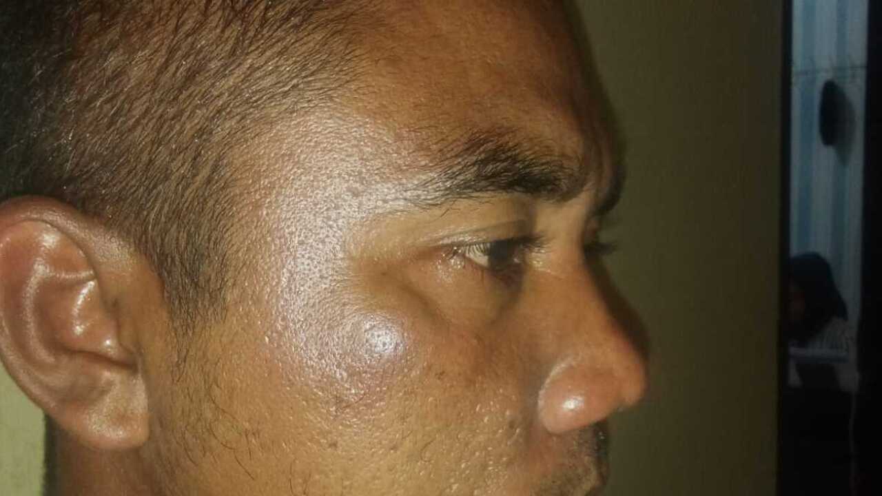 Pengusaha Batu Kapur di OKU Diduga Aniaya Sopir Truk