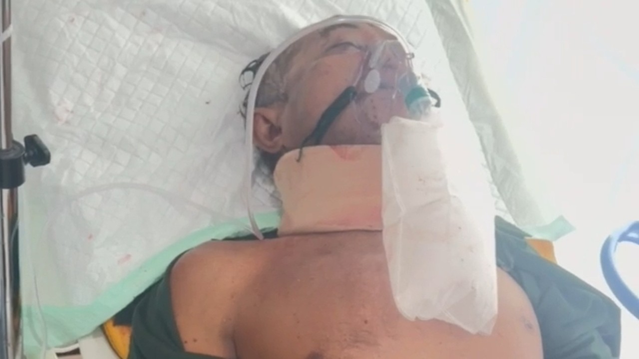 Masuk Lubang, Pengendara Revo Alami Luka Berat