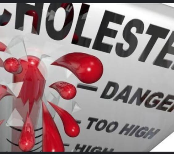 Agar Waspada, Yuk kita Kenali 5 Gejala Kolesterol Tinggi