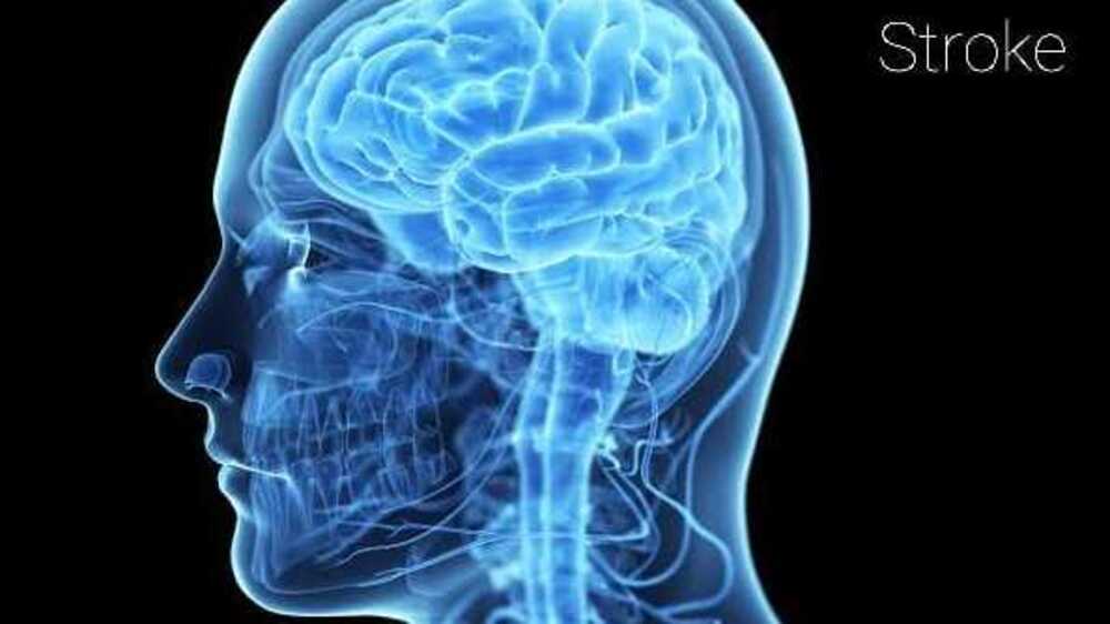 Agar Terhindar Dari Penyakit Stroke, Lakukan 11 Langkah ini