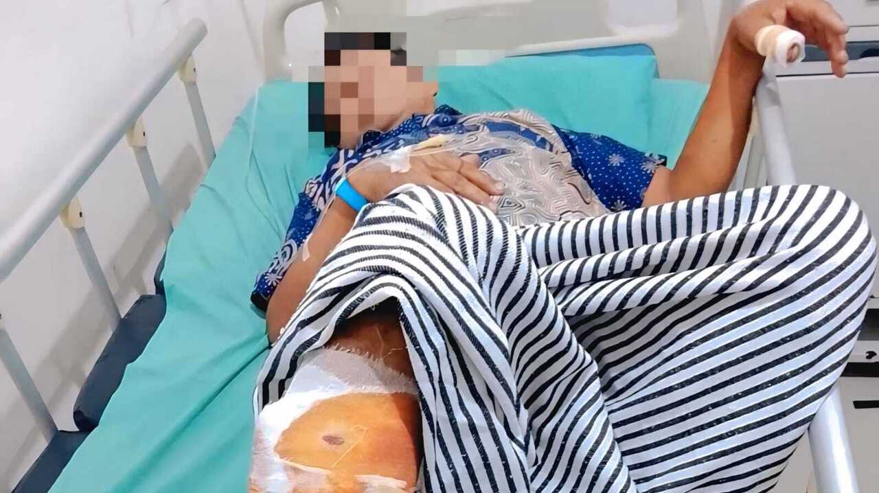 Seorang Warga OKU Diserang Beruang di Kebun Karet