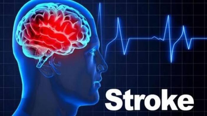 Catat ! ini 8 Cara Pencegahan Sejak Dini Agar Terhindar Dari Stroke