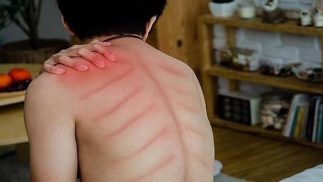 Tips Jitu Mengatasi Tubuh yang Mudah Masuk Angin