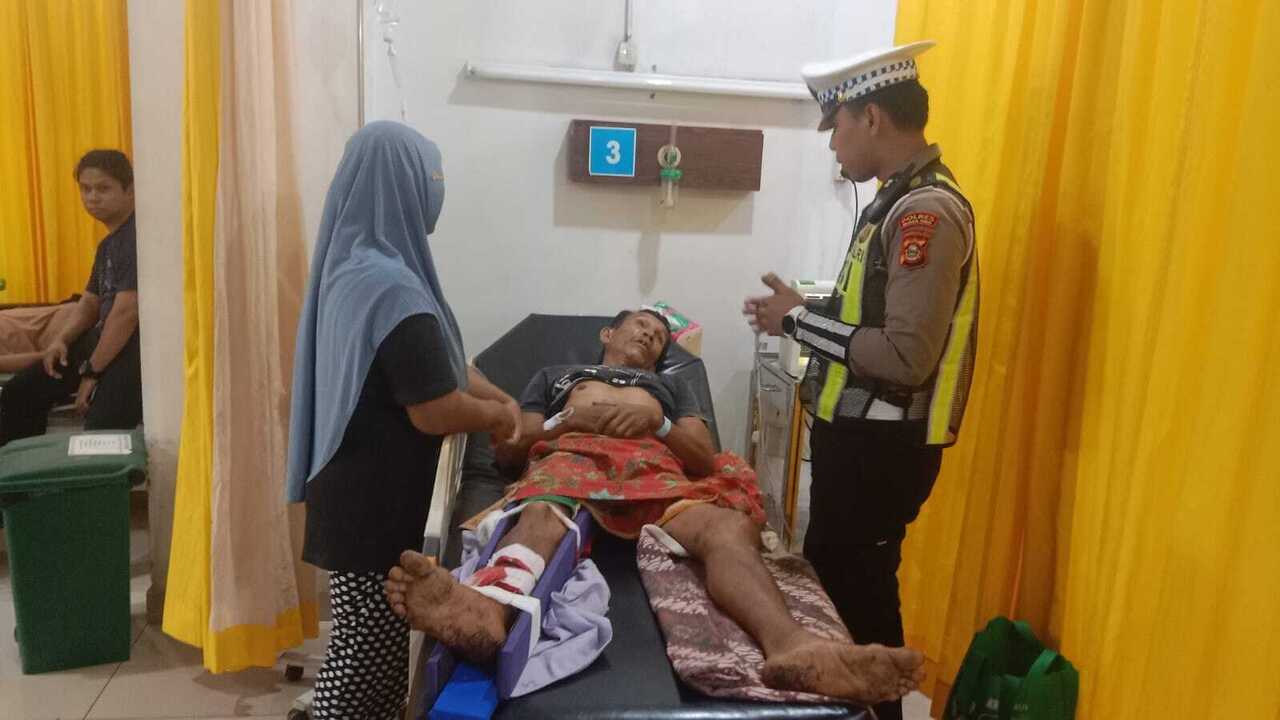 Motor Tabrak Dump Truk, Pengendara Patah Kaki