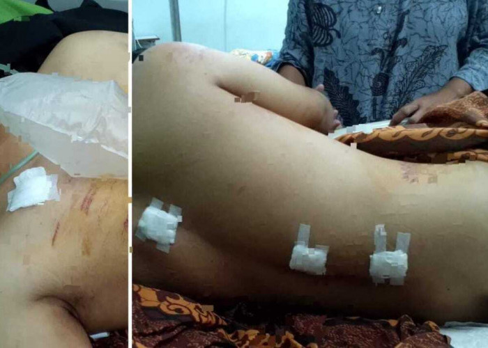 Jauh-Jauh Ingin Menemui Pujaan Hati, Malah Disambut Camer dengan 5 Kali Tikaman