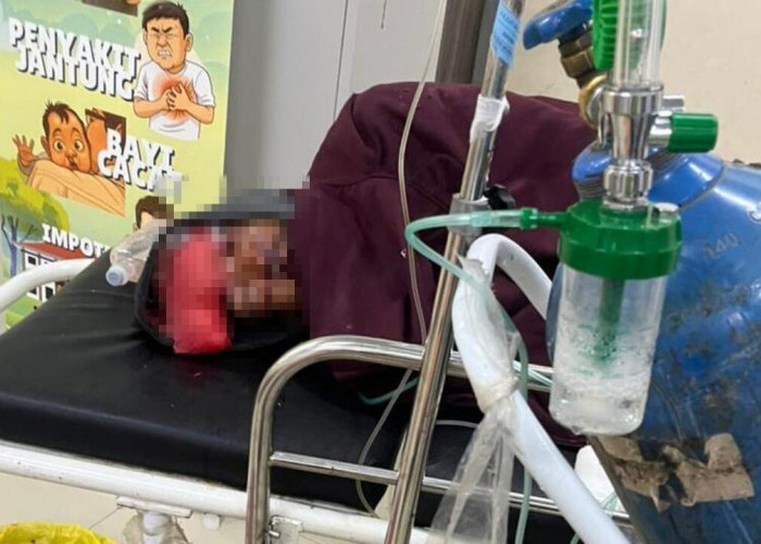 CRF vs PCX, 1 Tewas, 2 Luber dan 1 Luring