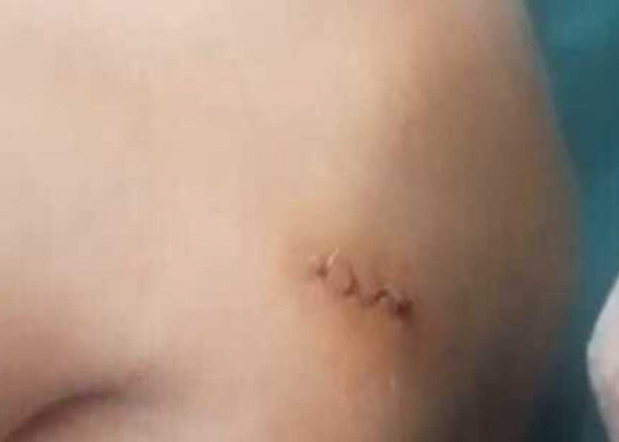 Seorang Petani di Rawas Ilir Jadi Korban Penganiayaan Brutal