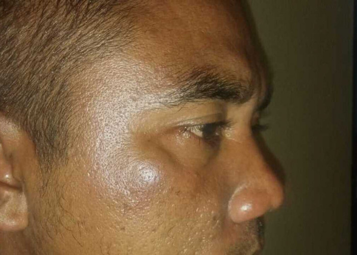 Pengusaha Batu Kapur di OKU Diduga Aniaya Sopir Truk