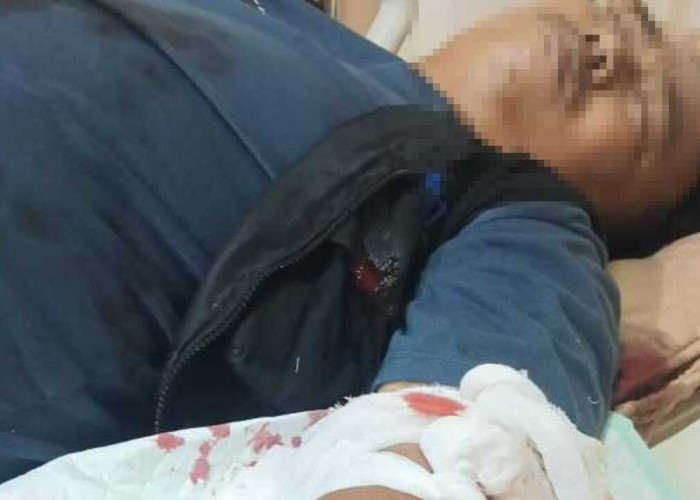 Suasana Pasar Inpres Kembali Mencekam, Seorang Penjaga Malam Nyaris Tewas Dibacok 