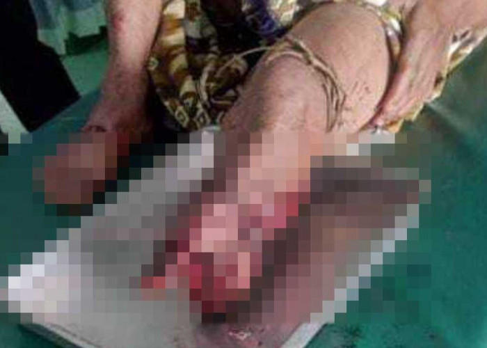 Diserang buaya kaki warga Megang Sakti Putus