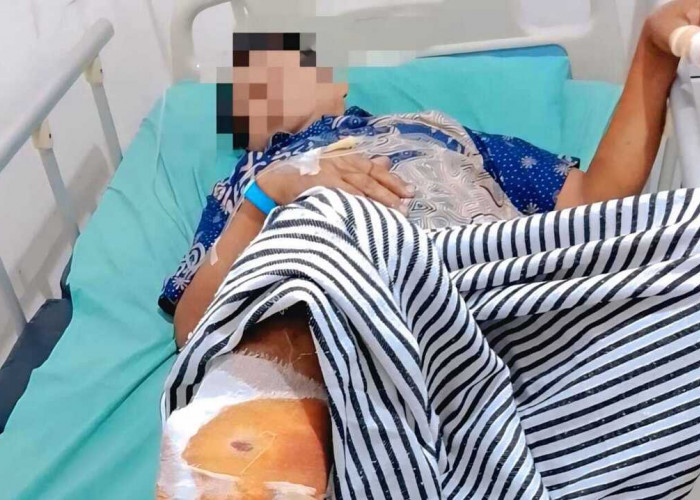 Seorang Warga OKU Diserang Beruang di Kebun Karet