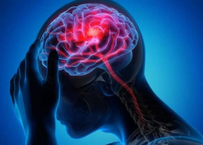 Cegah Bahaya Penyakit Stroke dengan Menerapkan Kebiasaan-Kebiasaan Ini!