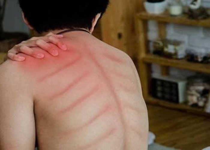 Tips Jitu Mengatasi Tubuh yang Mudah Masuk Angin