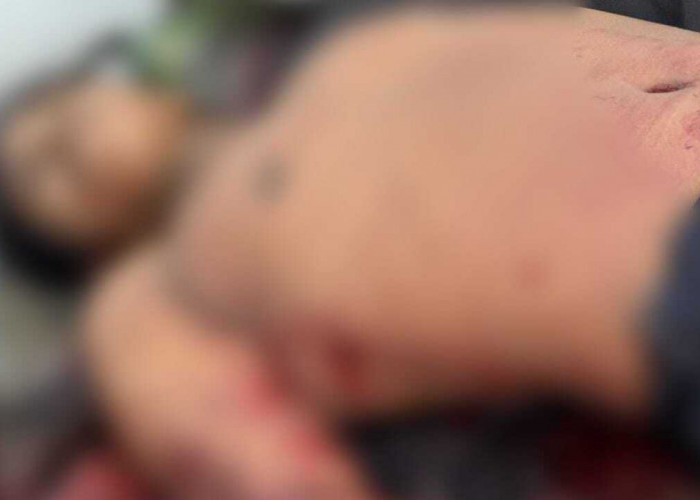 Pemuda Tewas ditemukan dengan Luka Tusuk di dada Kanan, Polisi Lakukan Penyelidikan 