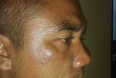 Pengusaha Batu Kapur di OKU Diduga Aniaya Sopir Truk