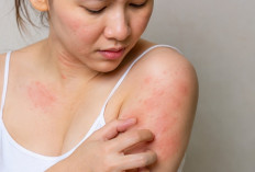 10 Bahan Alami yang Ampuh Membantu Meredakan Alergi, Begini Cara Konsumsinya