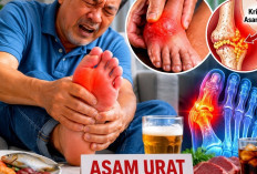 Asam Urat: Ini Pemicu dan Cara Mengatasi Secara Alami 